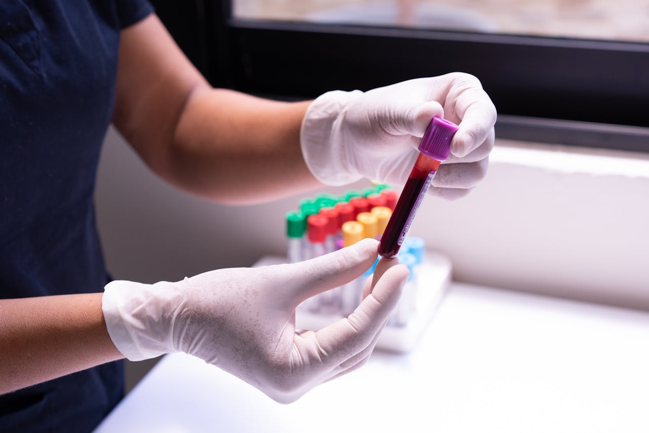 service-02 Gloved hands carefully handling a blood sample in a medical or laboratory environment.
