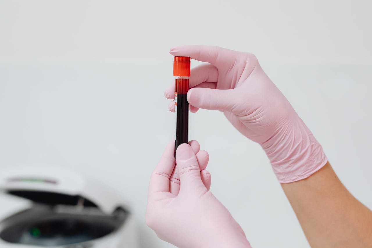 service-06 Close-up of gloved hands holding a blood sample in a test tube, ideal for medical and lab contexts.